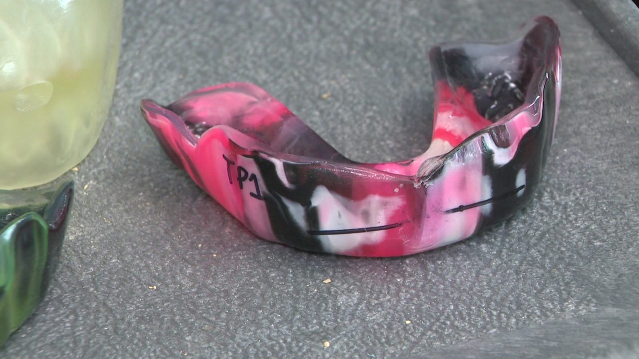 There are benefits of mouth guards beyond protecting your teeth All benefits of